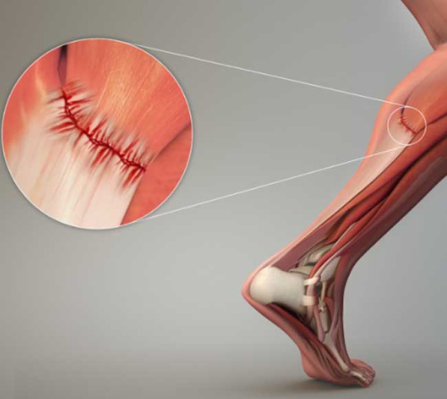 Consult With Expert Orthopedic Surgeons in Dubai with Patientexperts.co
